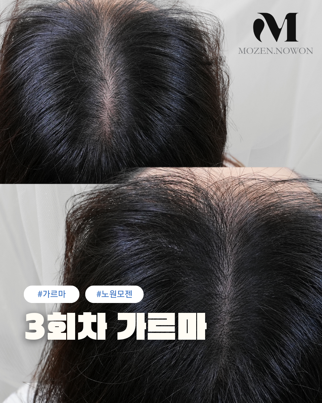 모젠SMP 노원 대표 이미지