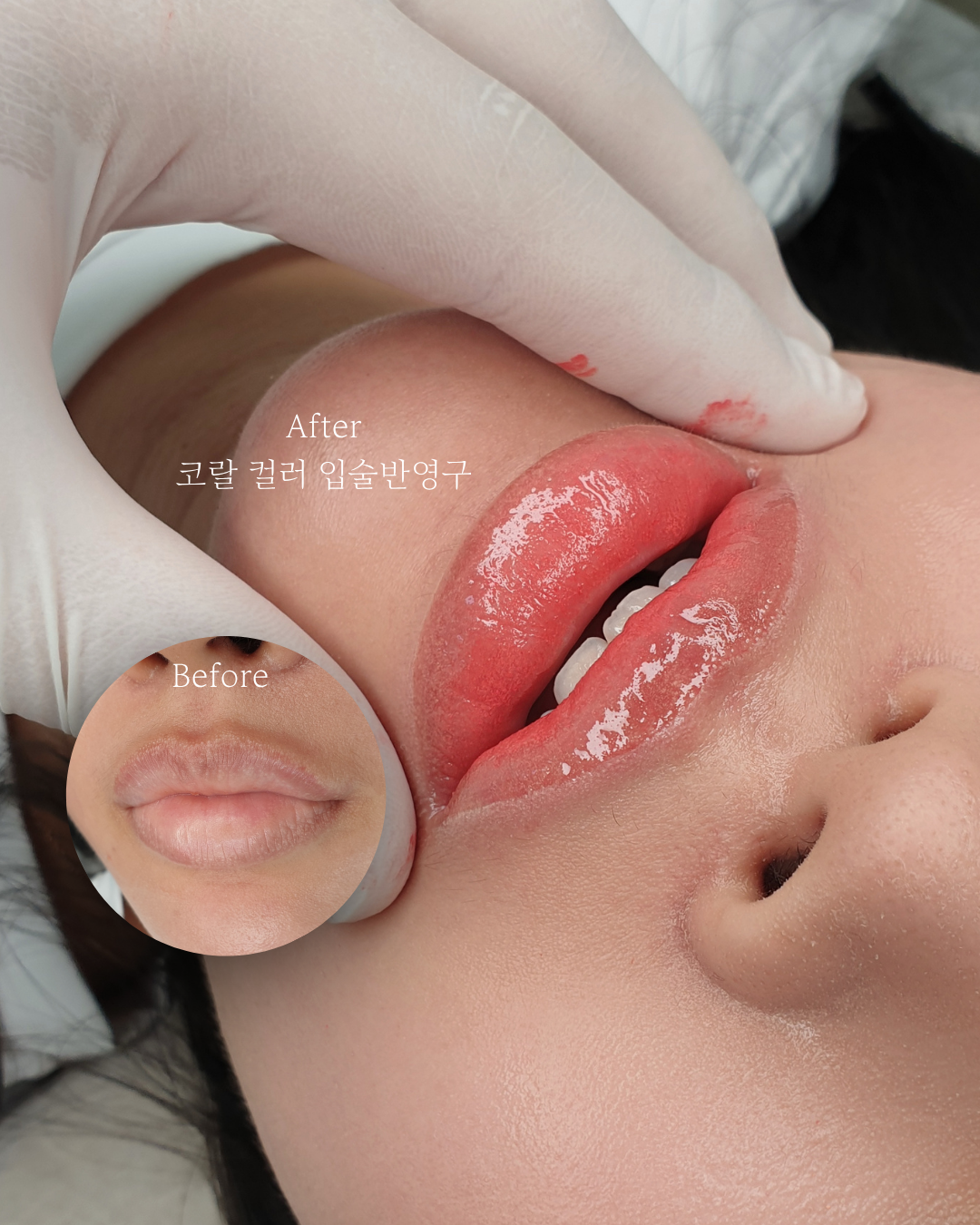 톡스앤필브로우 강남본점 대표 이미지