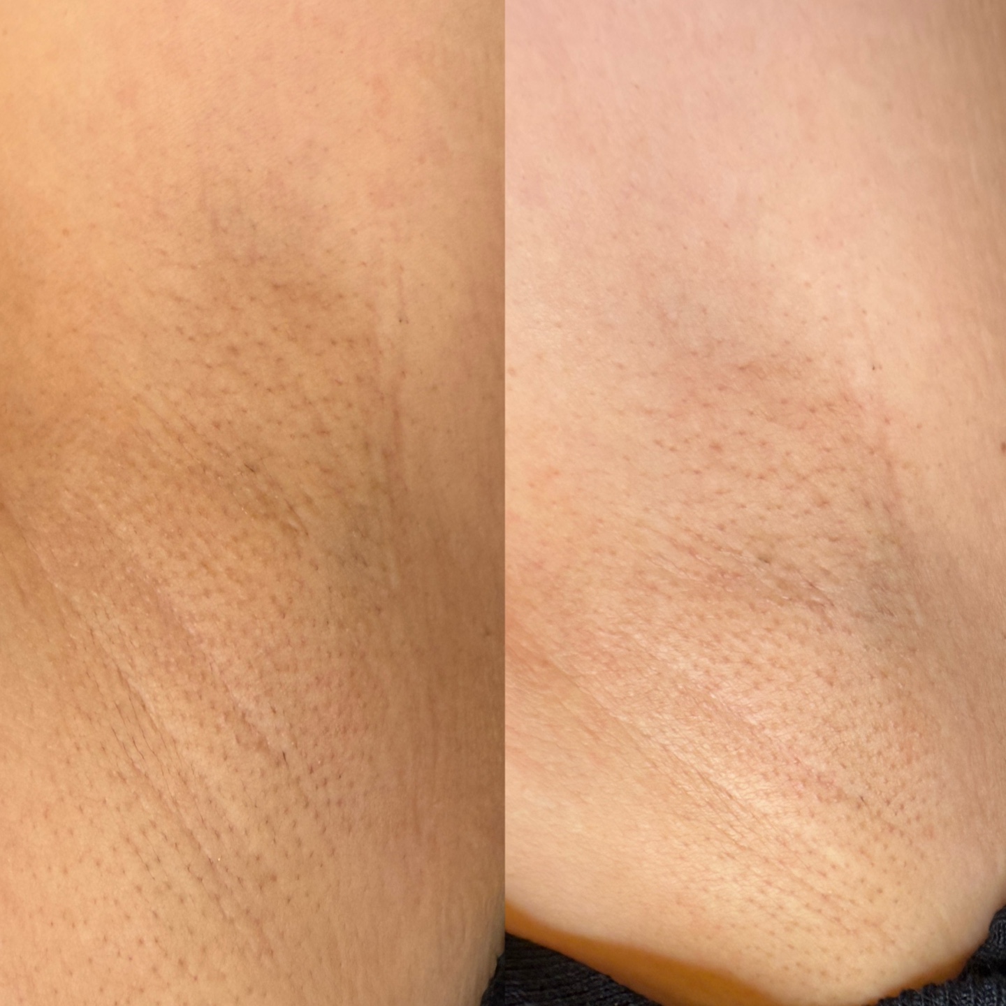 리봄 스킨앤바디 대표 이미지