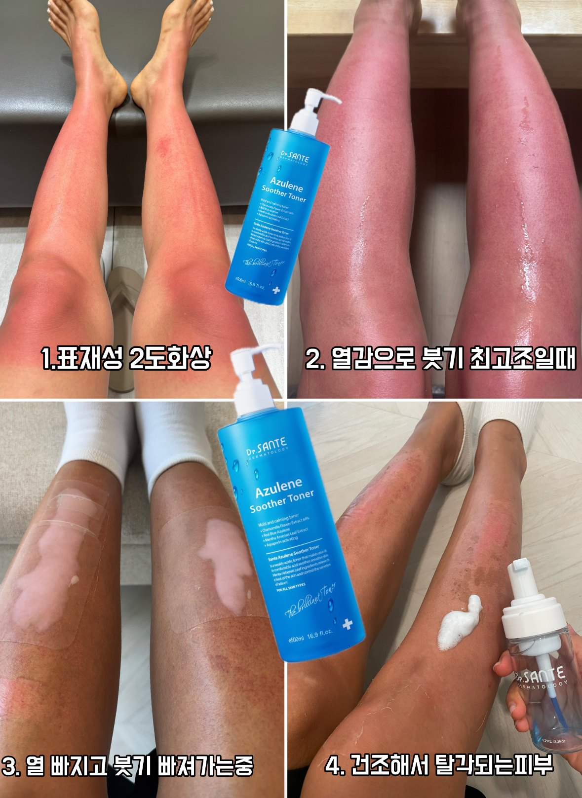 에토프뷰티샵 시술 사진