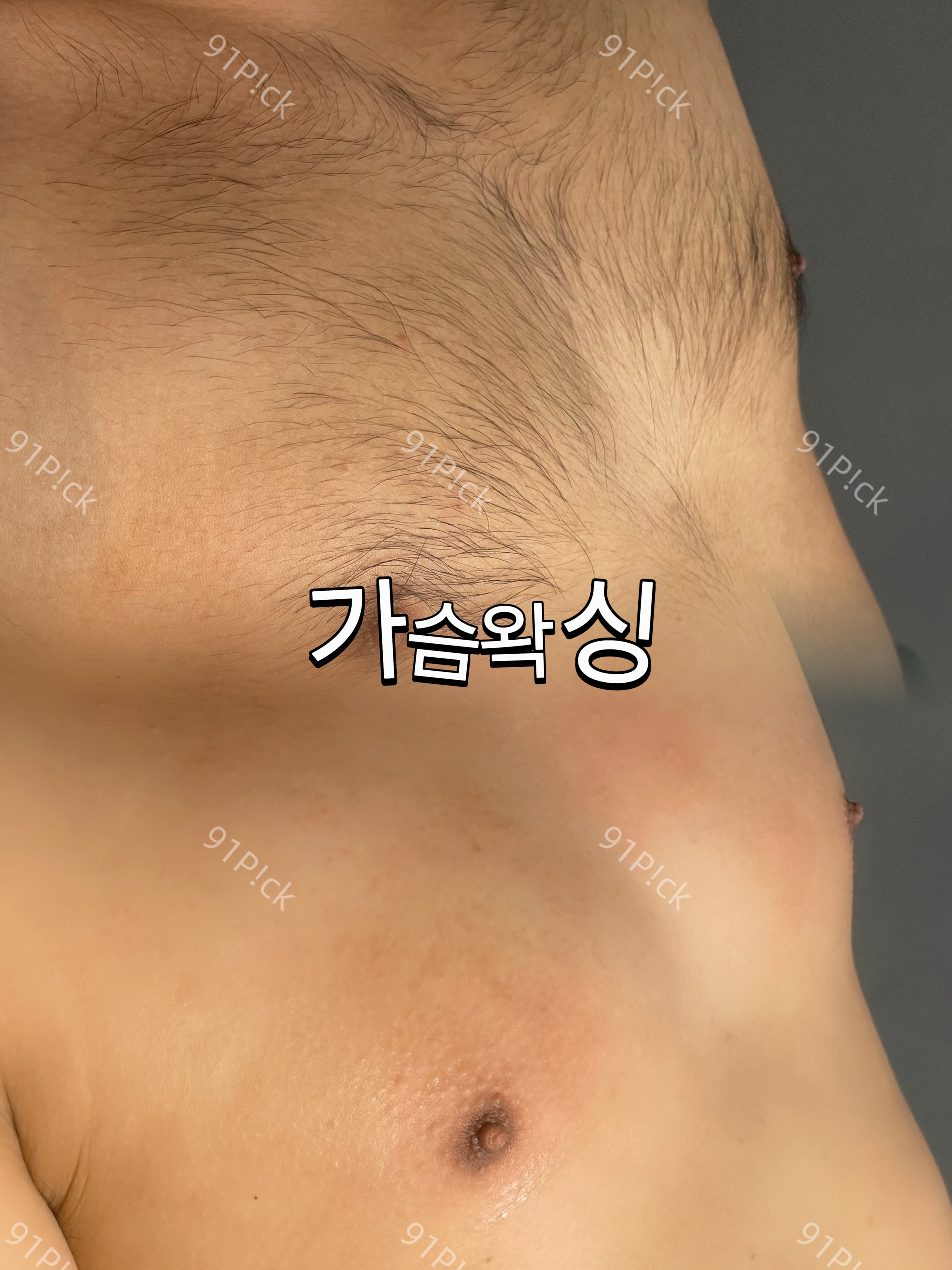 미아 91픽 대표 이미지