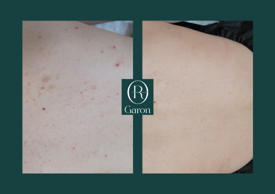 가론에스테틱 대표 이미지