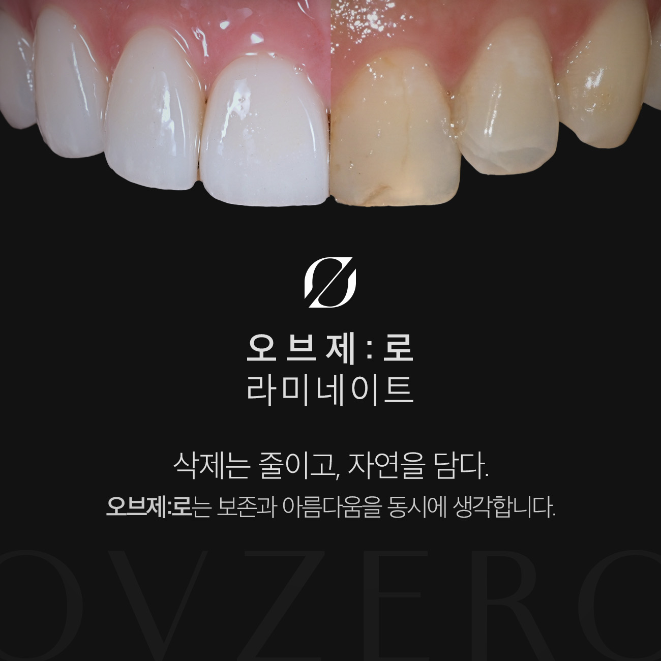 서울오브치과병원 대표 이미지