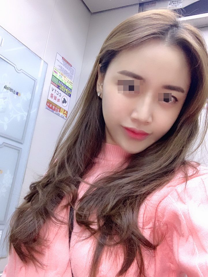 체인지의원 시술 결과 이미지