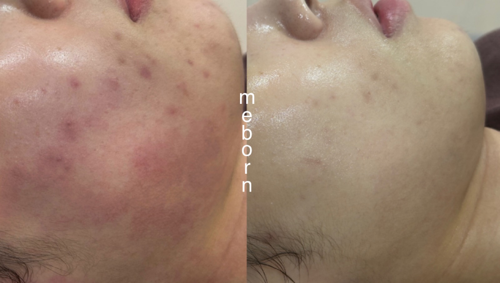 미본에스테틱 대표 이미지