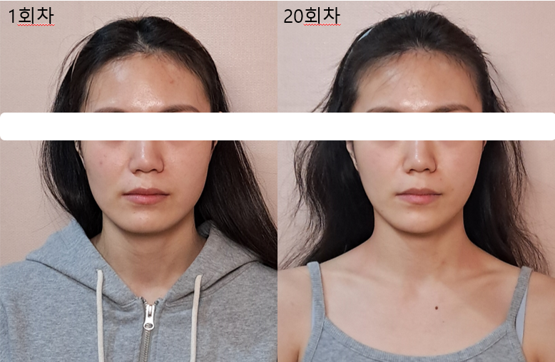 창조 페이스바디 대표 이미지