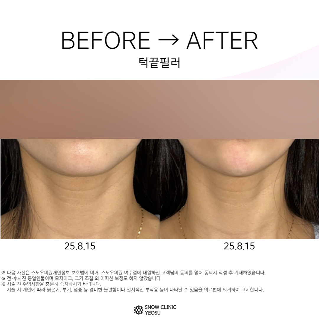 스노우의원 여수점 대표 이미지