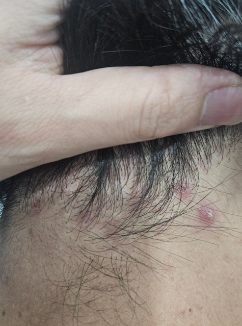 스칼프메디 대표 이미지