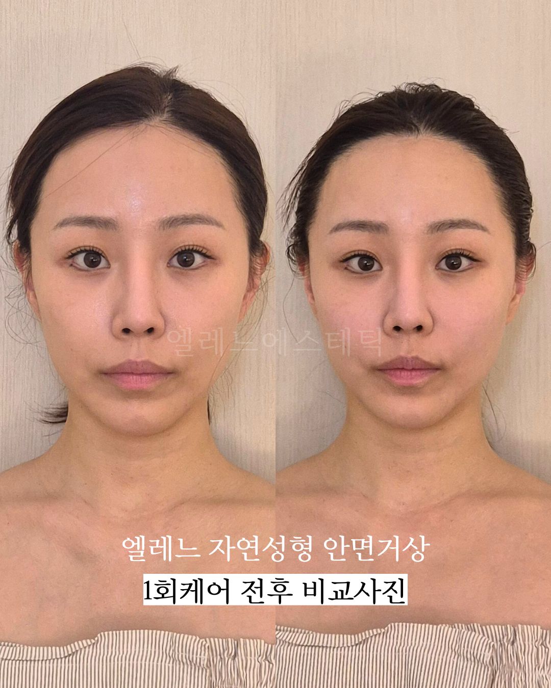 엘레느 에스테틱 대표 이미지