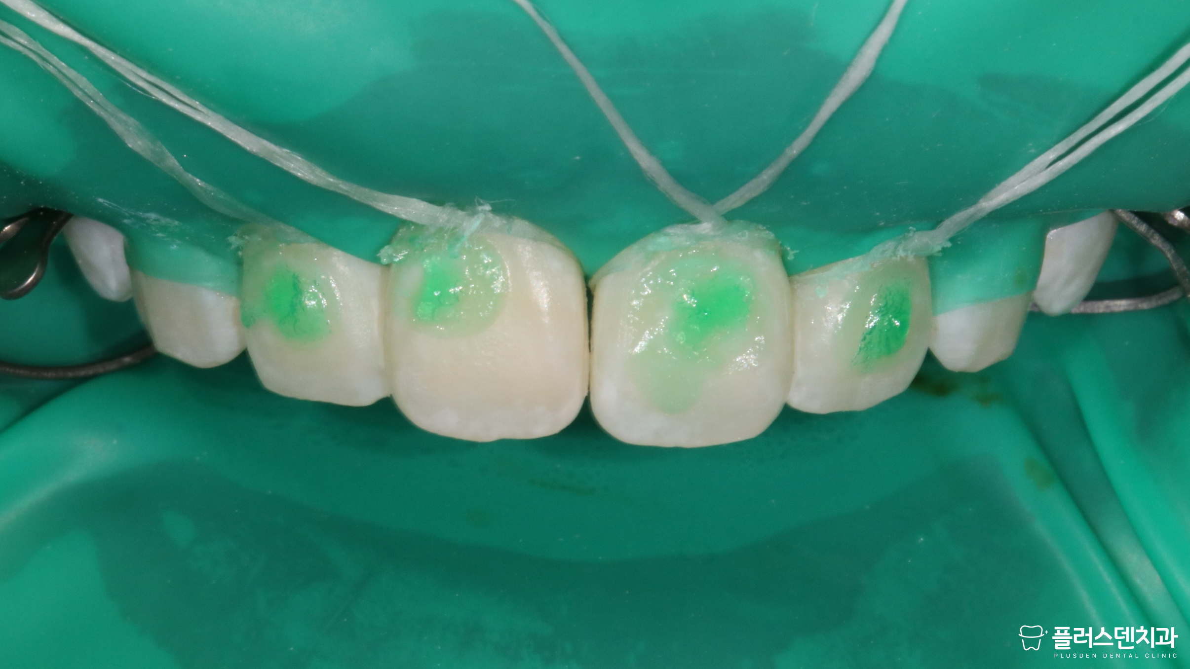 플러스덴치과의원 대표 이미지