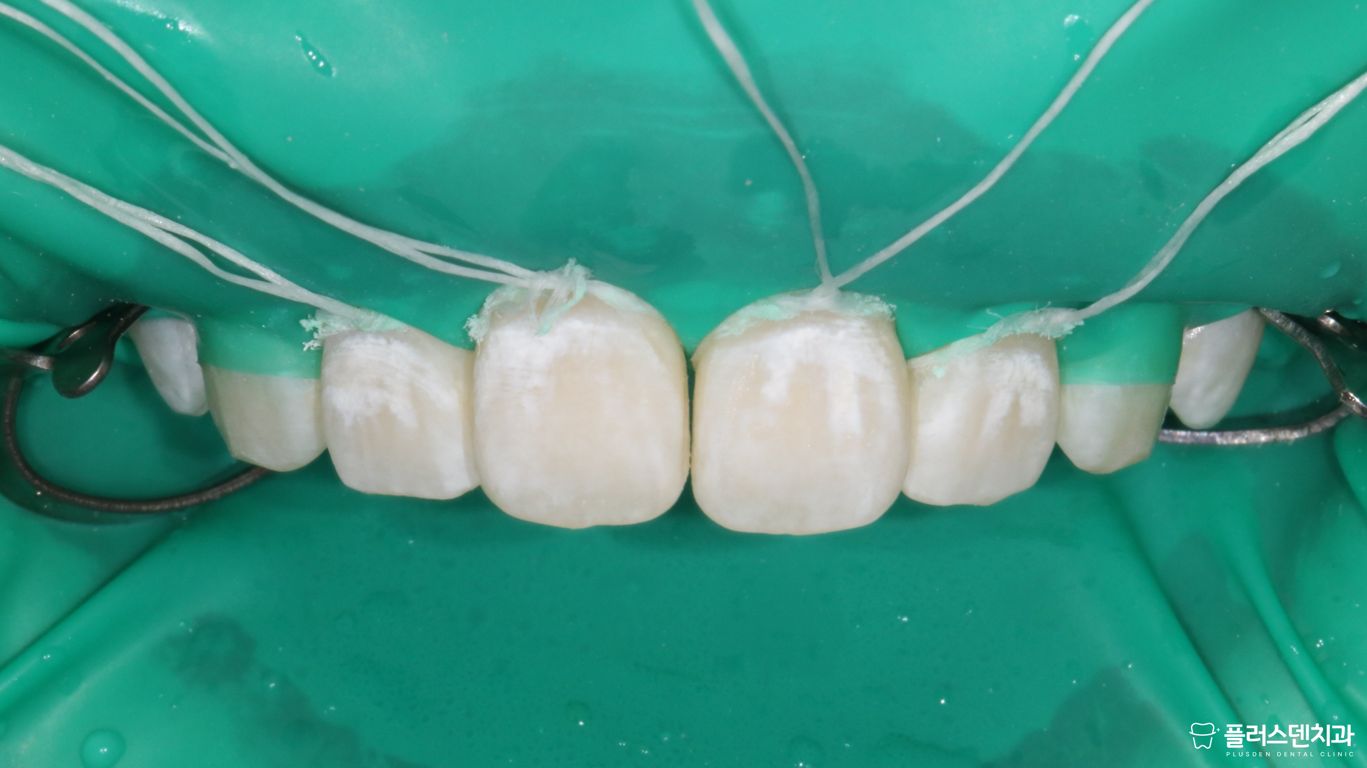 플러스덴치과의원 대표 이미지