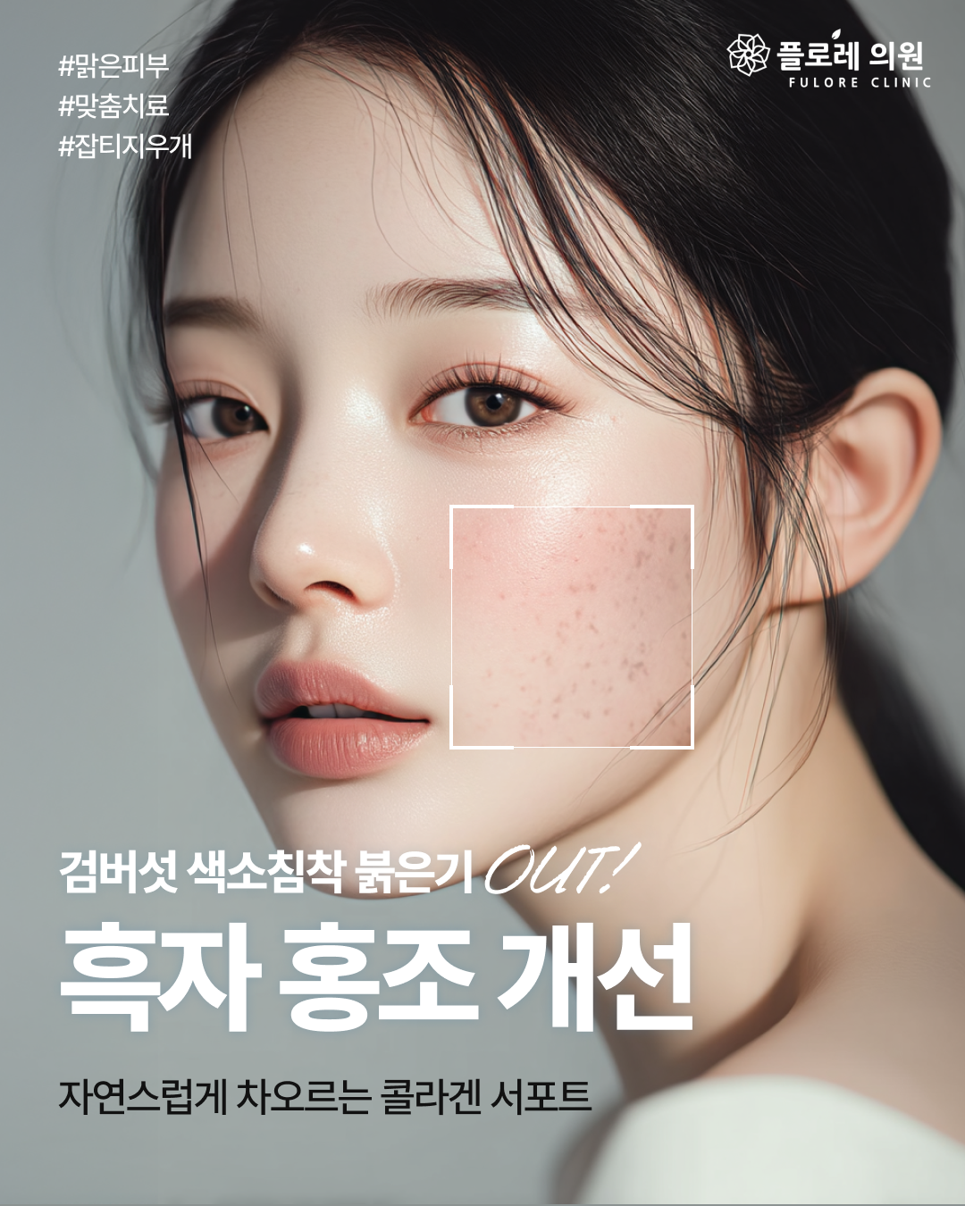 플로레의원 대표 이미지