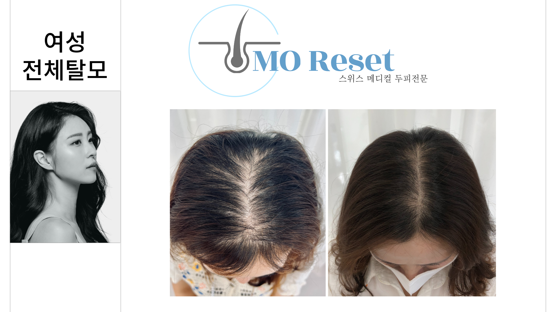 모리셋두피재생센터 서초점 대표 이미지
