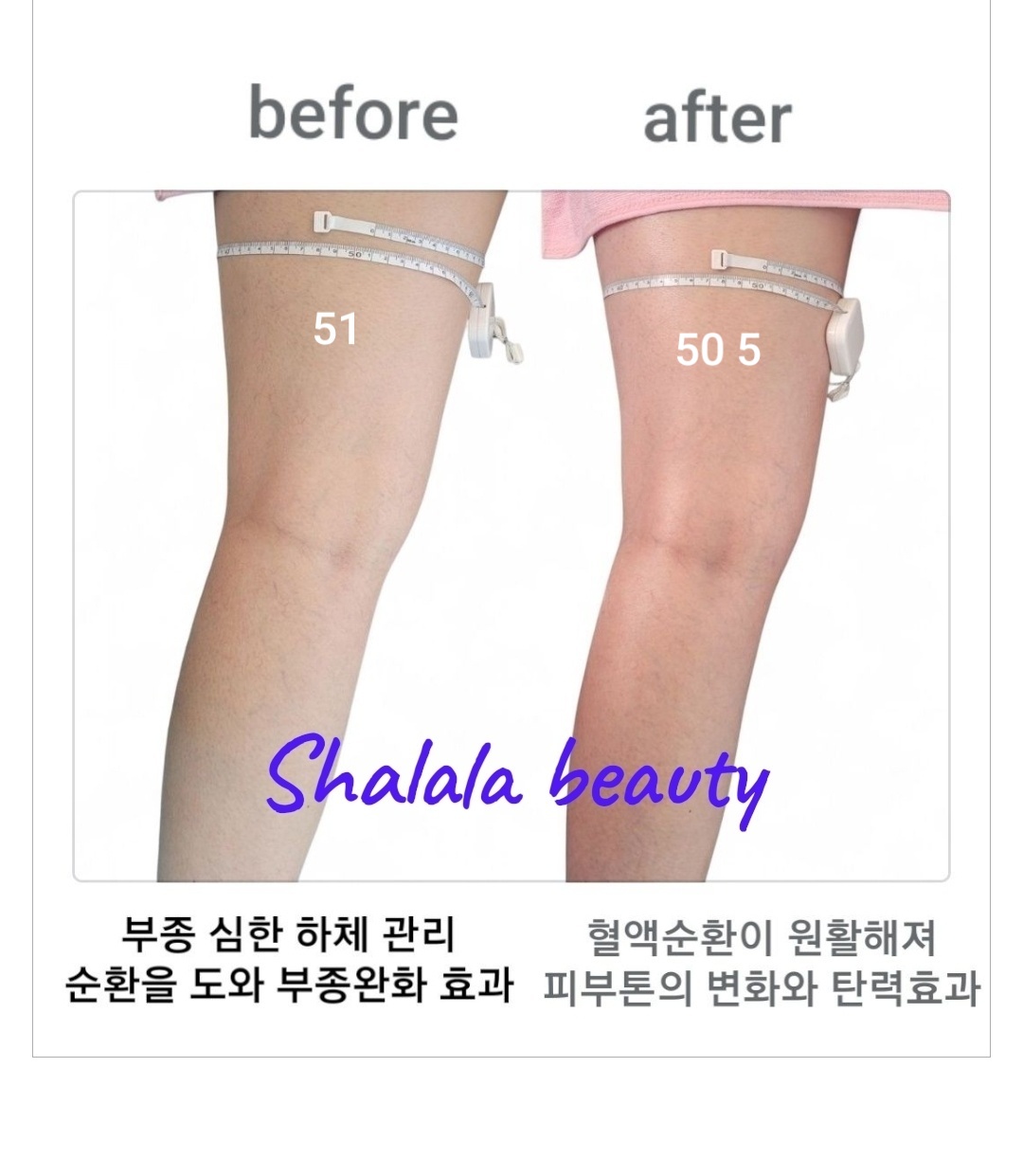 샤랄라뷰티 photo 4