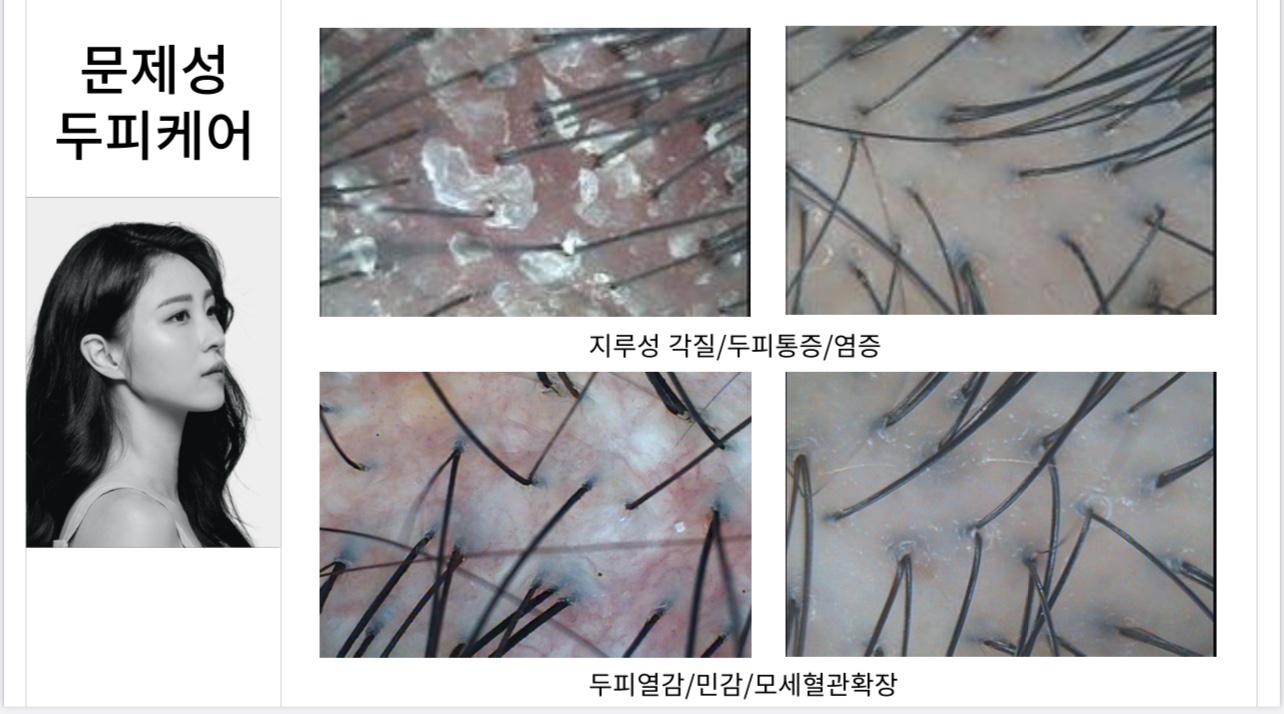 모리셋두피재생센터 서초점 대표 이미지