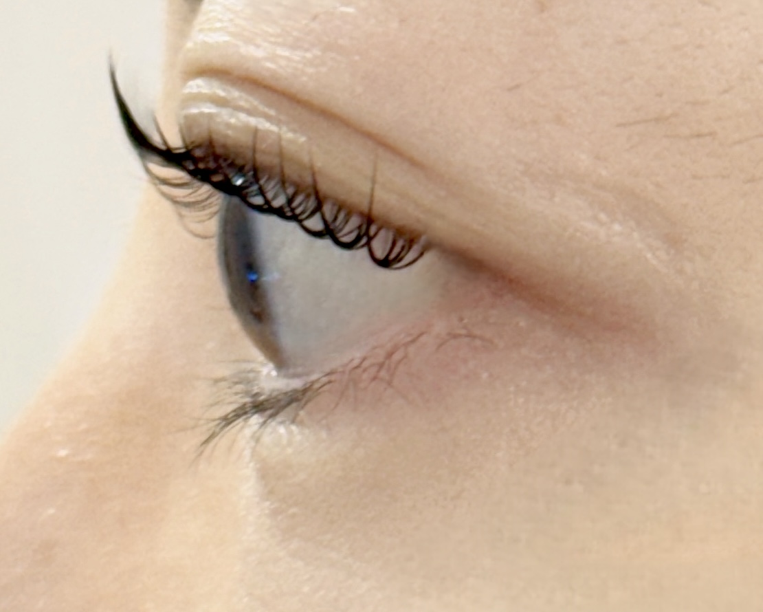 로아래쉬 대표 이미지 - 