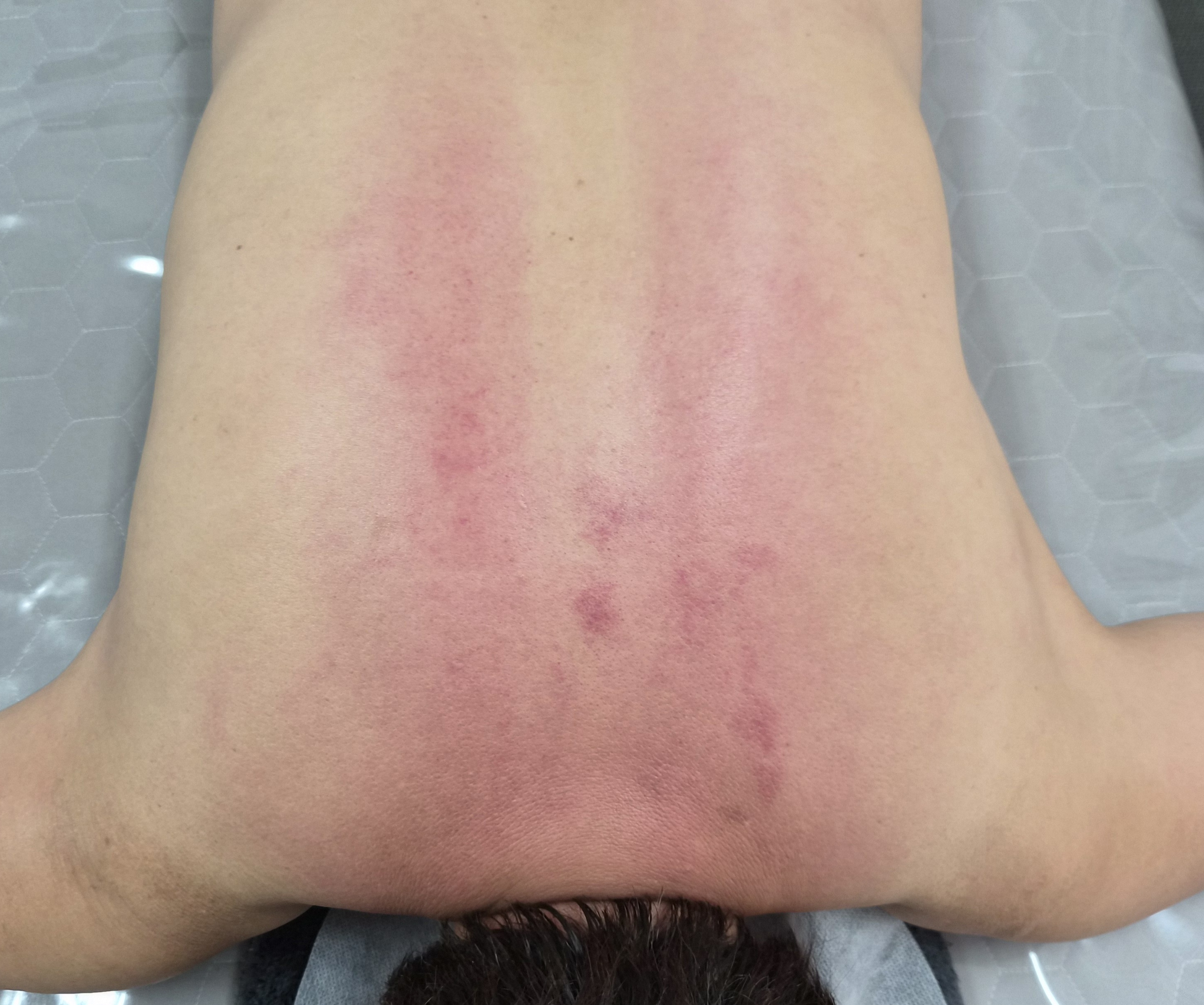 체리베리뷰티 photo 7