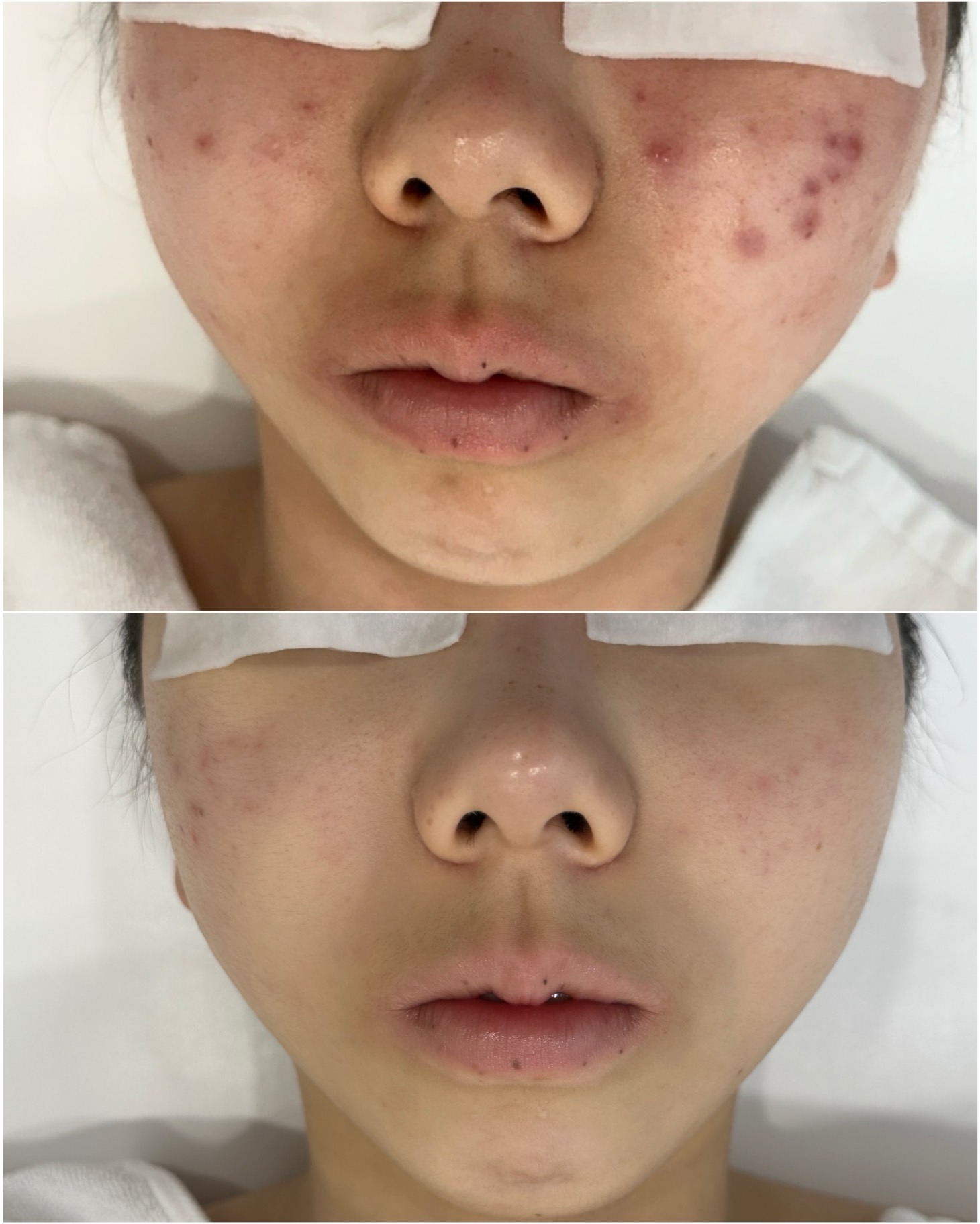 하이필스킨 대표 이미지