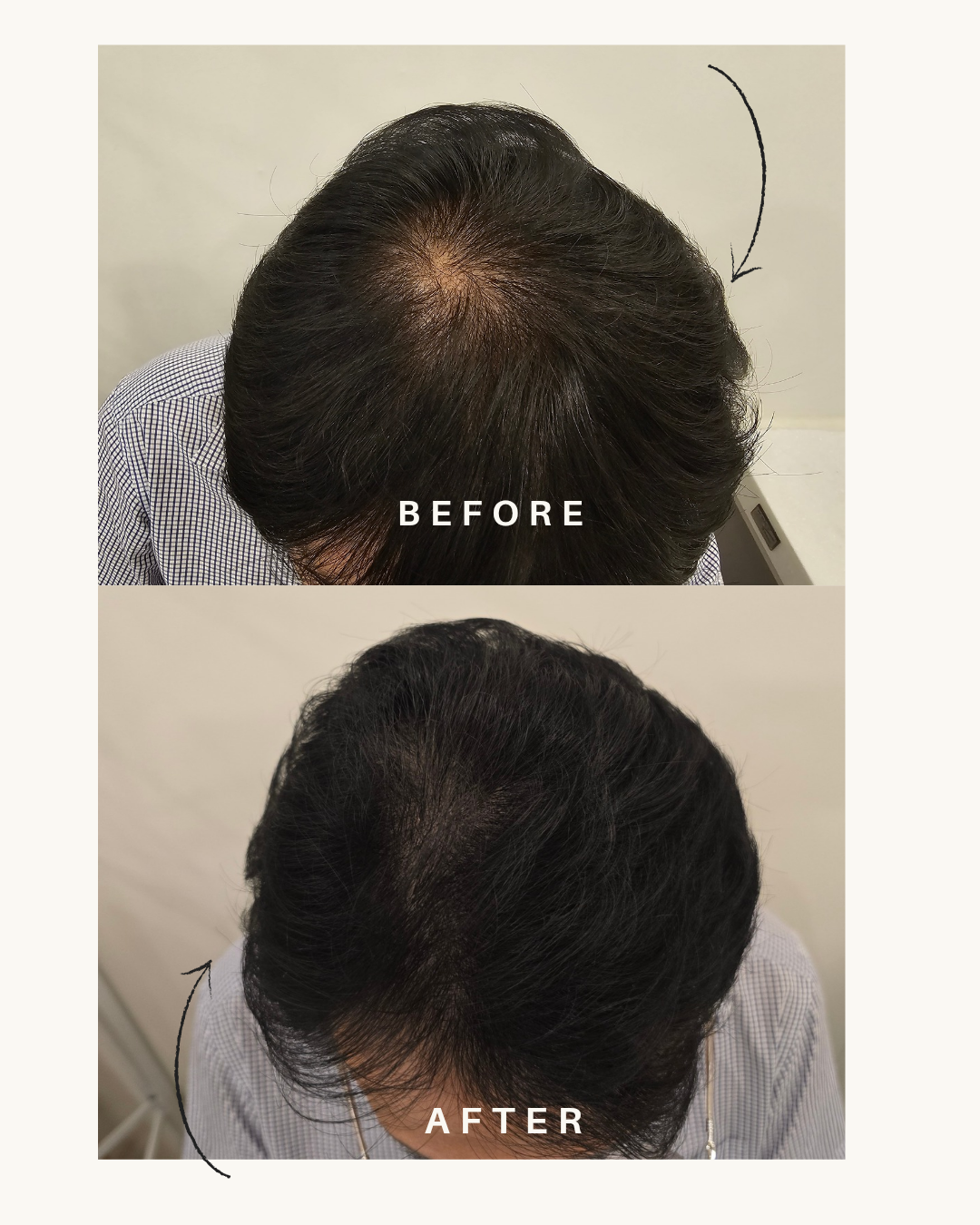 보떼드스파 검단본점 대표 이미지