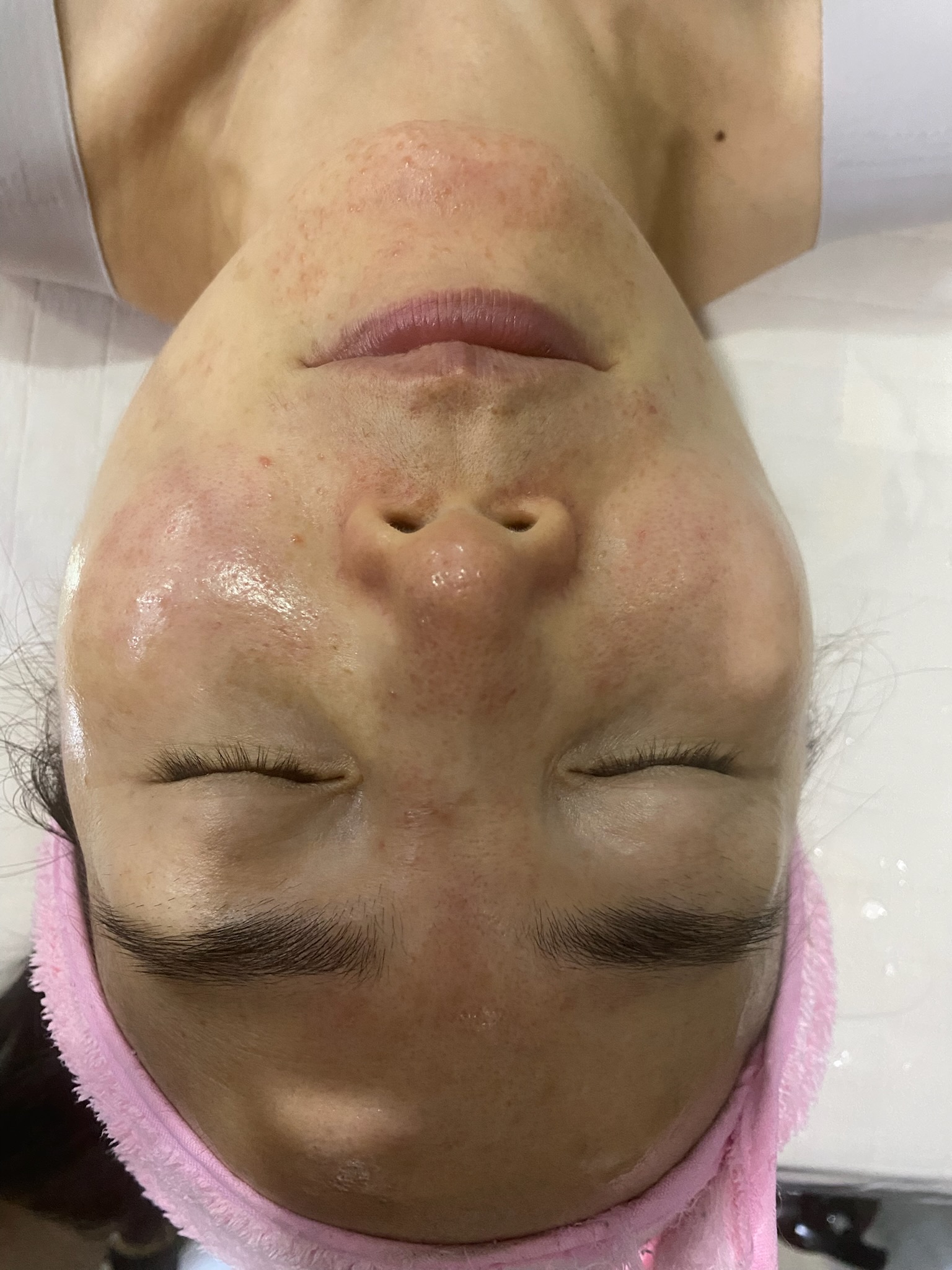 Relax skin 대표 이미지