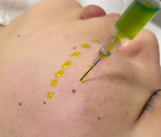 하이필스킨 여의도점 대표 이미지