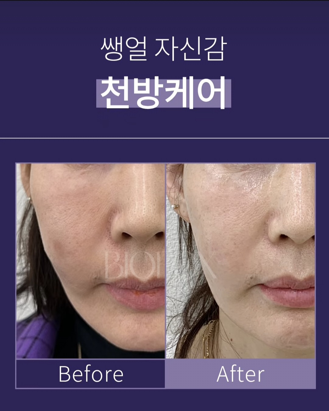 예쁜얼굴 photo 4