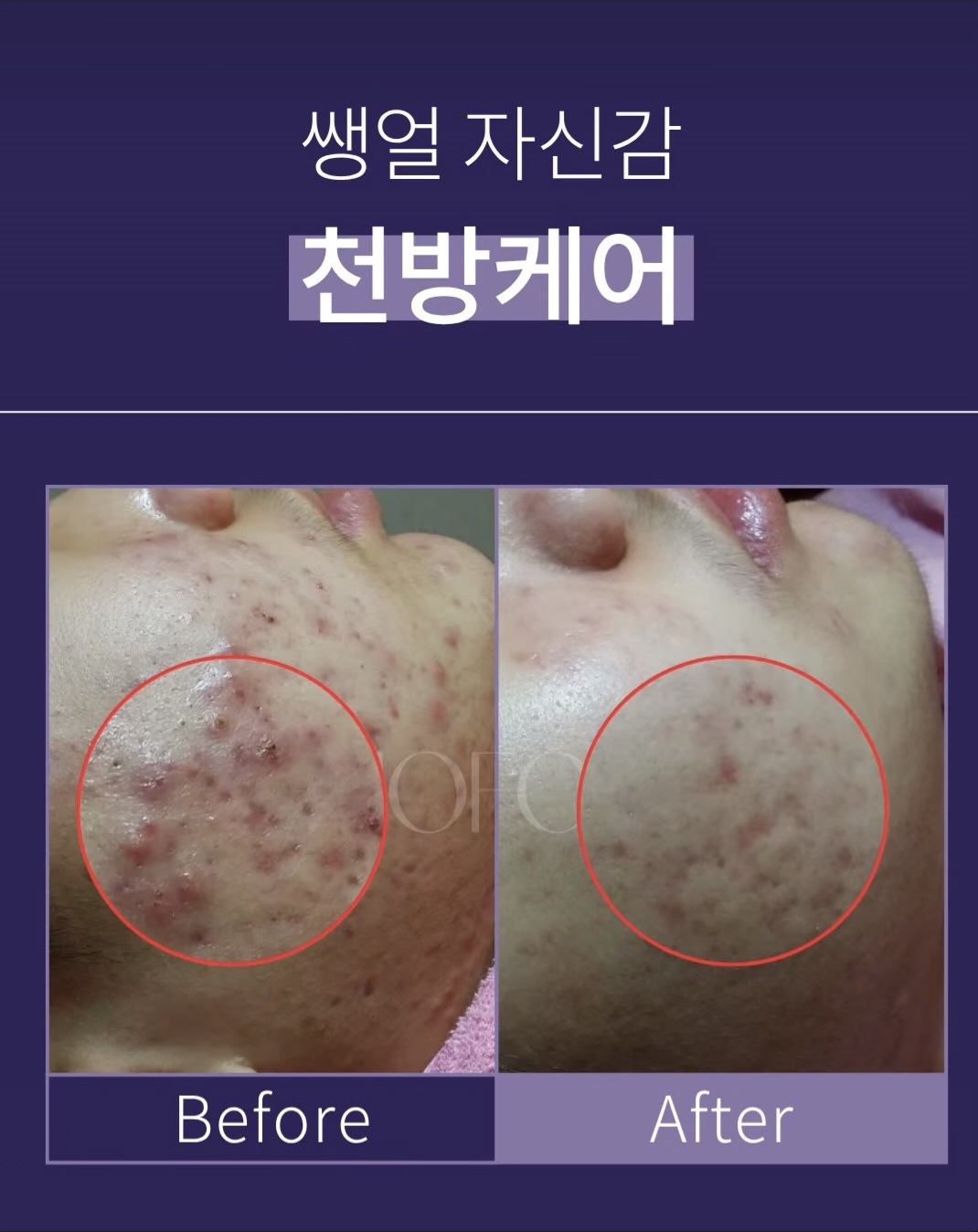 예쁜얼굴 photo 2