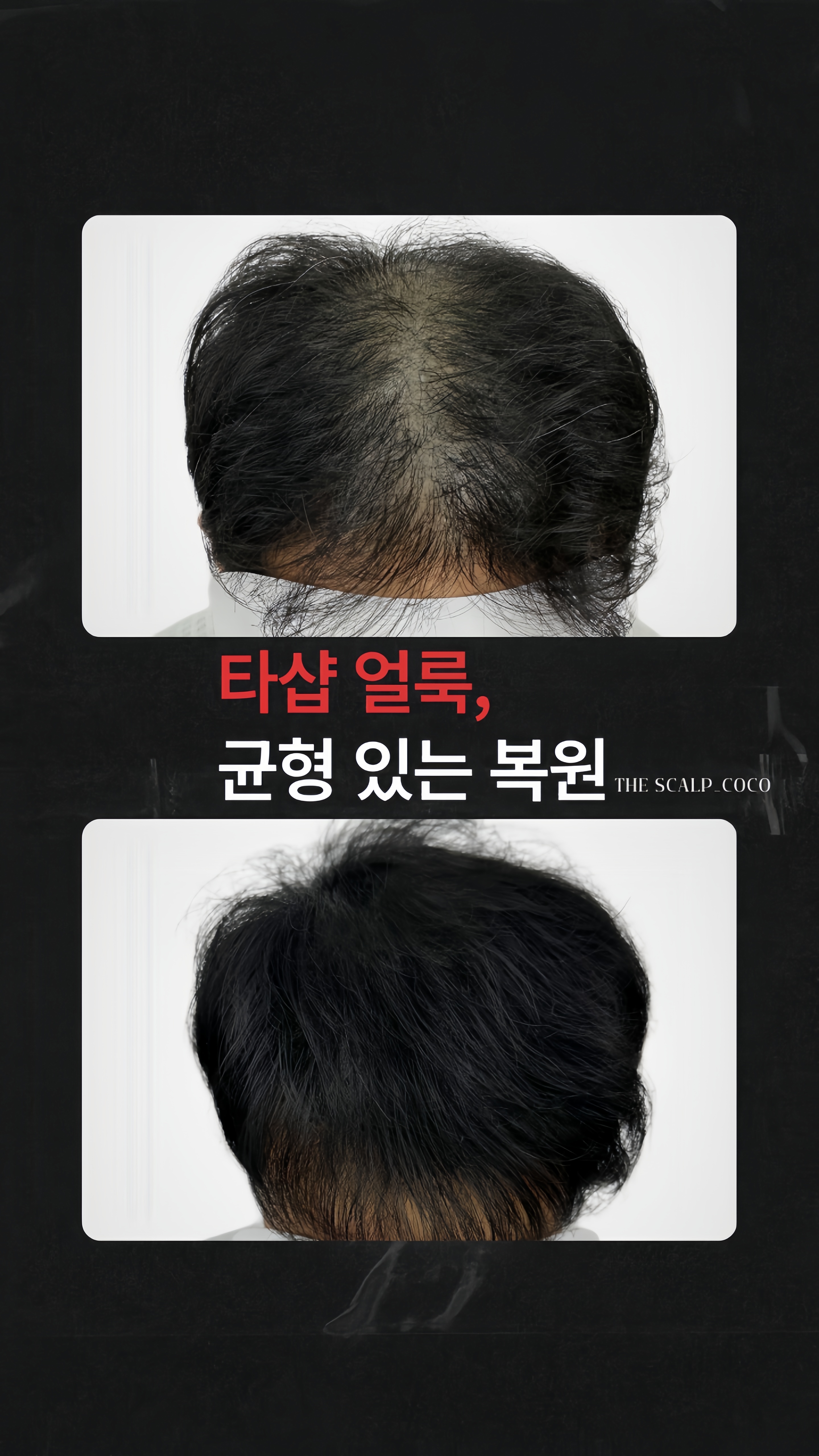 더스칼프 춘천점 대표 이미지