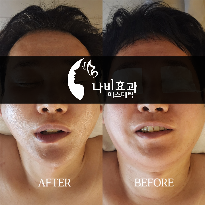 나비효과에스테틱 대표 이미지