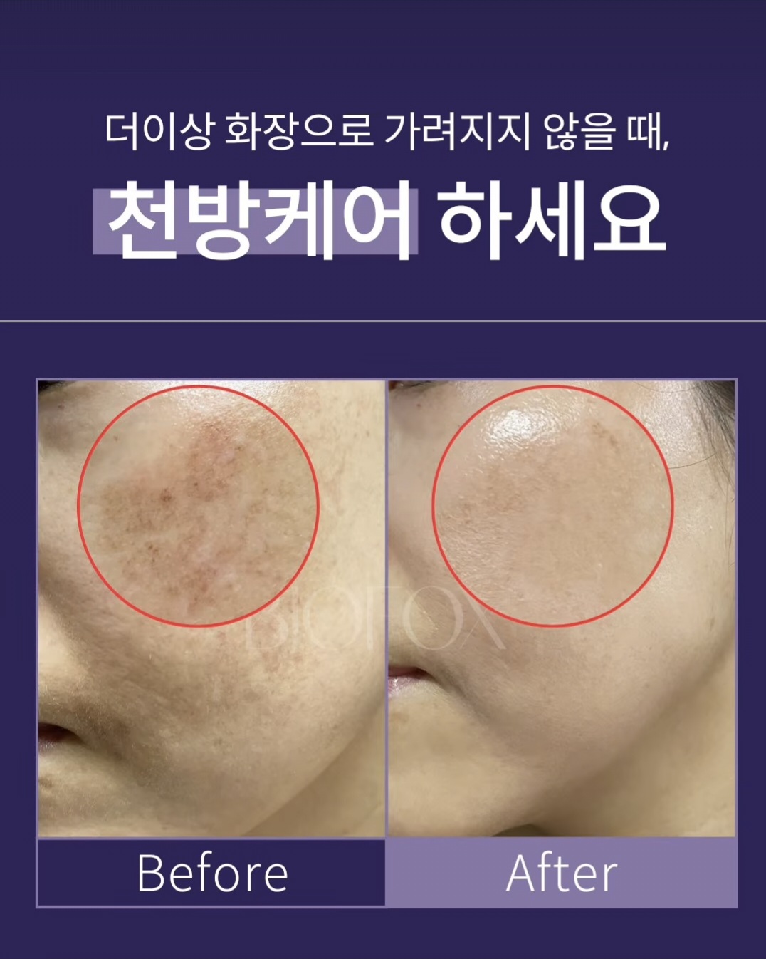 예쁜얼굴 photo 3