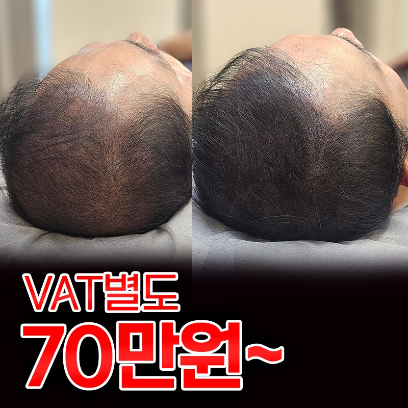 포항JK한방병원 두피문신센터 대표 이미지