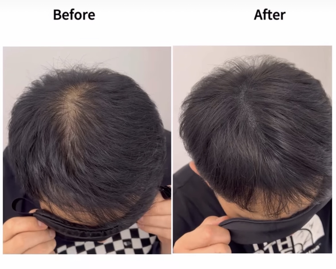 어썸스칼프 대표 이미지