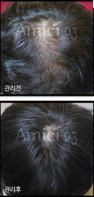 아미치0.3 순천점 대표 이미지
