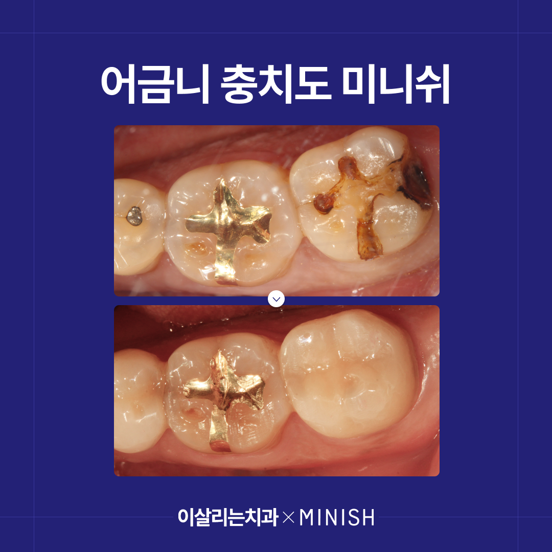 이살리는치과의원 대표 이미지