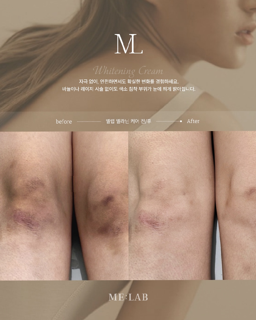 어우러지다 대표 이미지