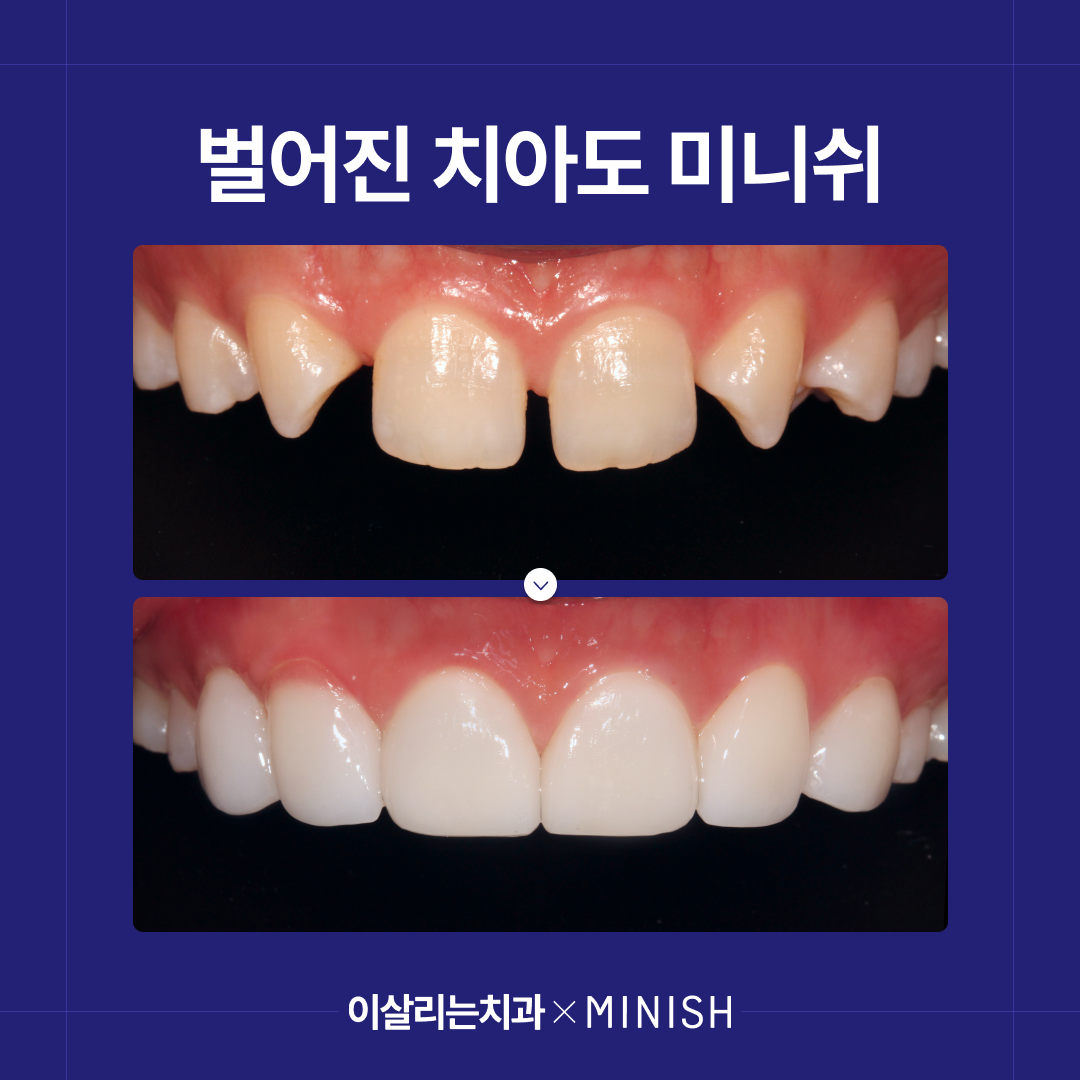 이살리는치과 대표 이미지