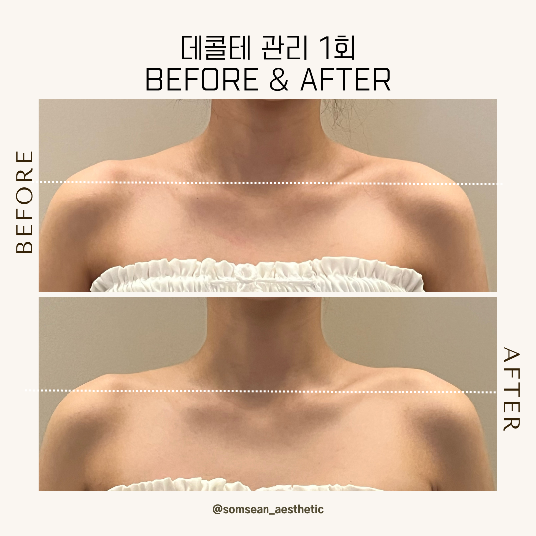 솜세안피부샵 photo 6