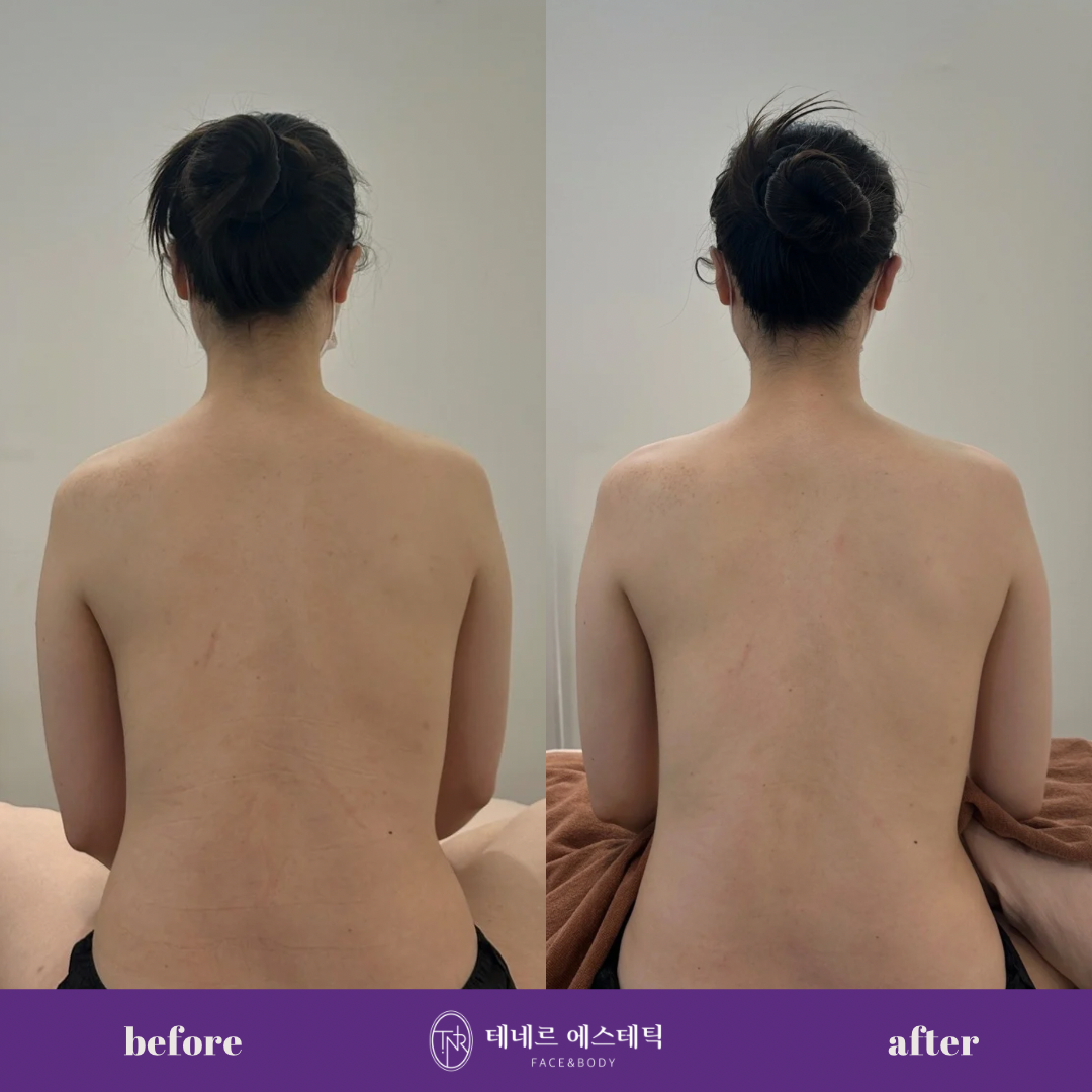테네르 에스테틱 대표 이미지