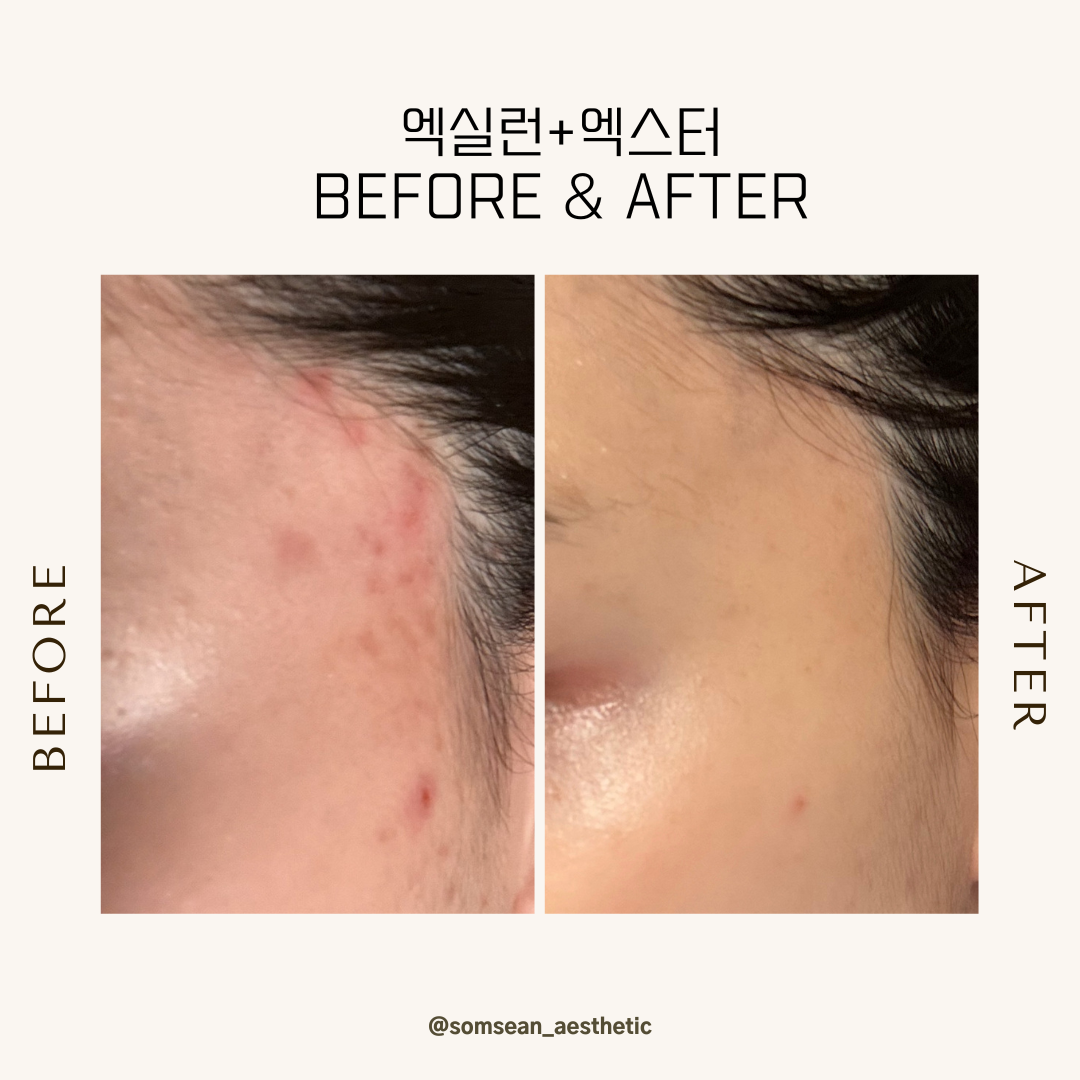 솜세안피부샵 photo 7
