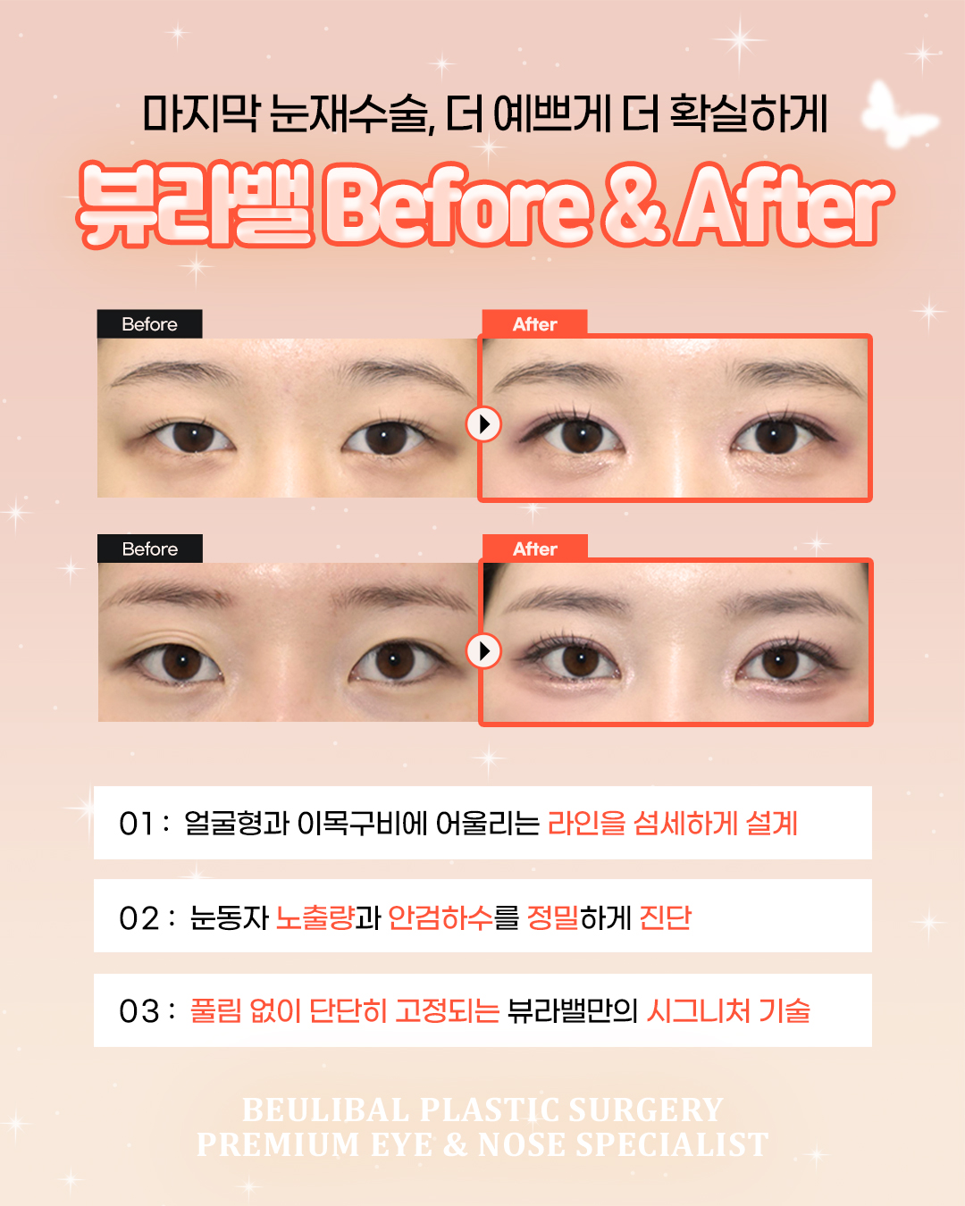 뷰라밸성형외과의원 대표 이미지