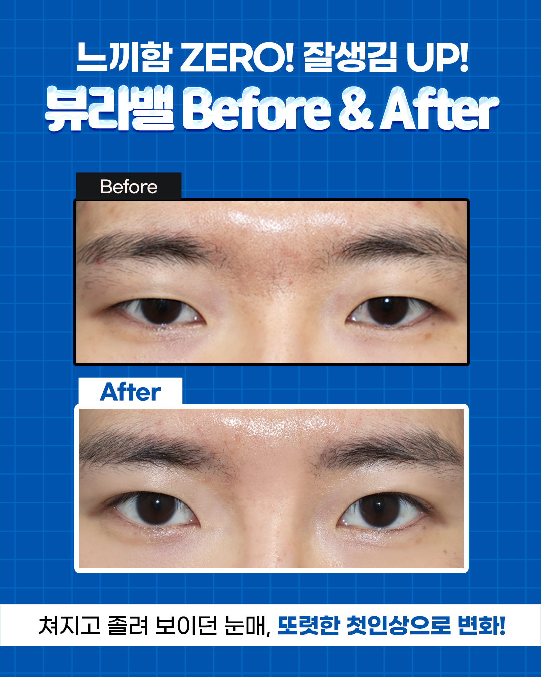 뷰라밸성형외과의원 대표 이미지