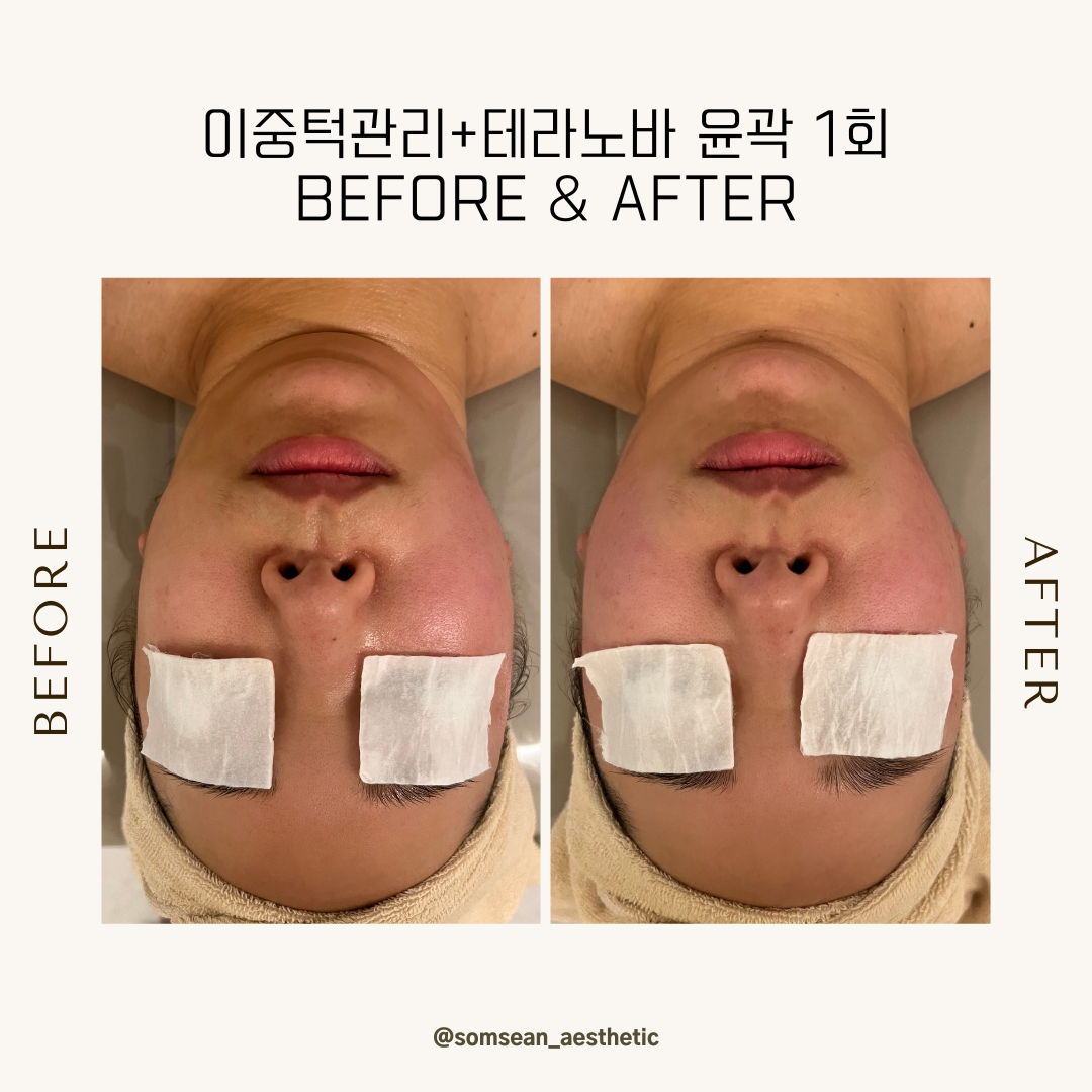 솜세안피부샵 photo 4
