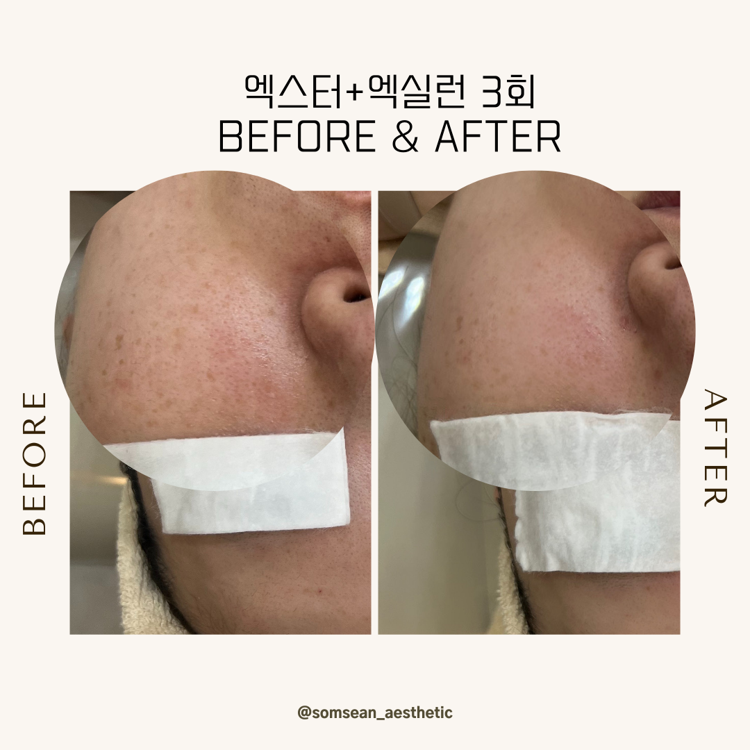 솜세안피부샵 photo 3