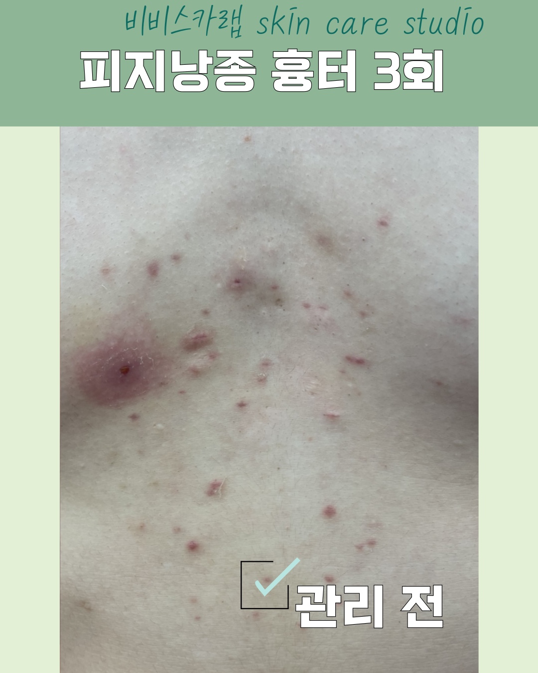 비비스카랩 대표 이미지