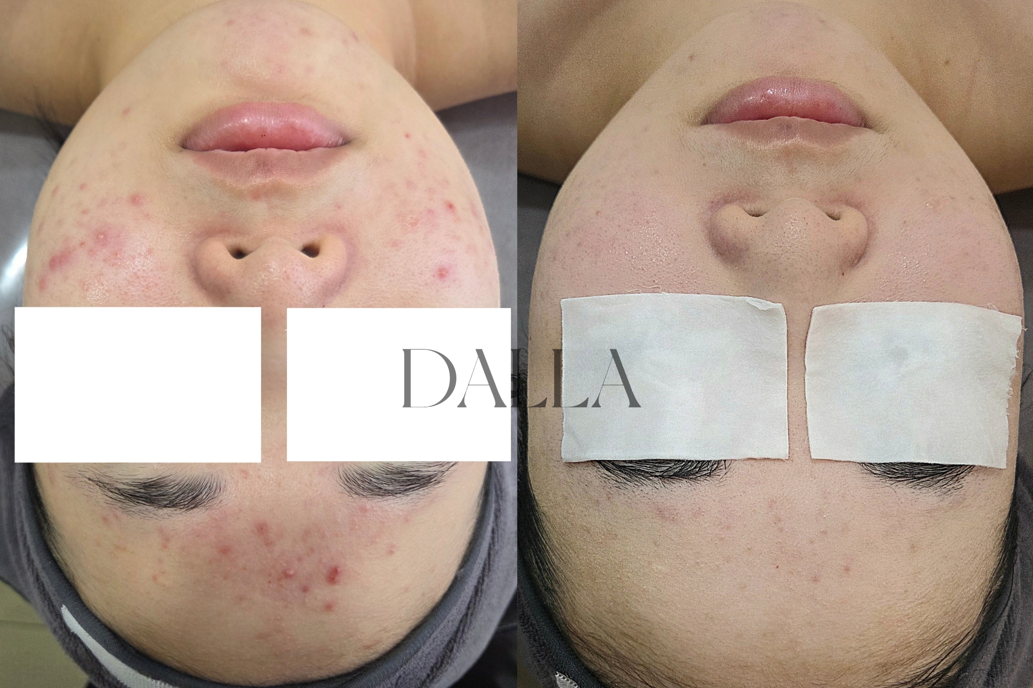 달라뷰티 대표 이미지