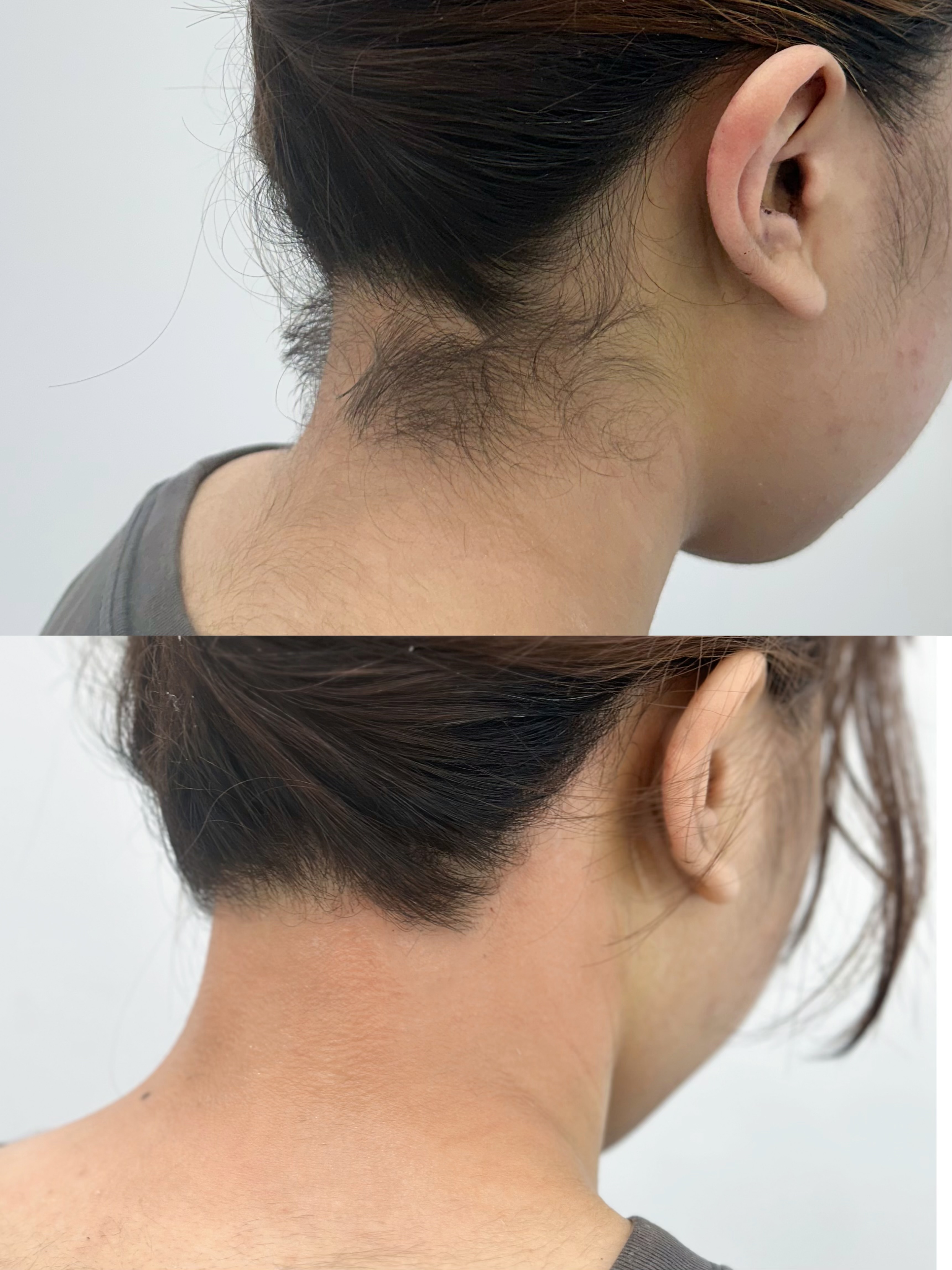 오월 에스테틱 대표 이미지