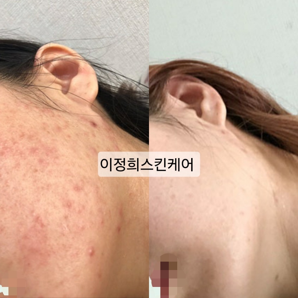 이정희스킨케어 대표 이미지