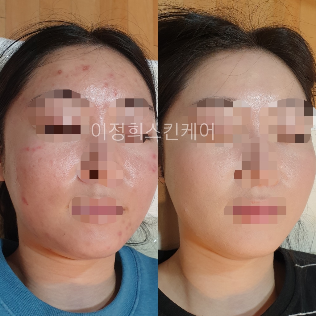 이정희스킨케어 대표 이미지