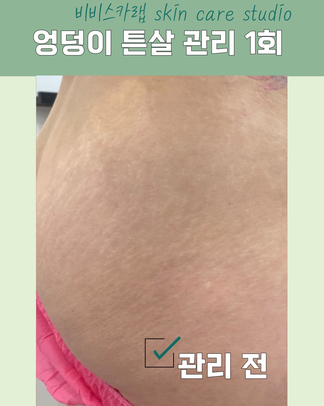 비비스카랩 대표 이미지