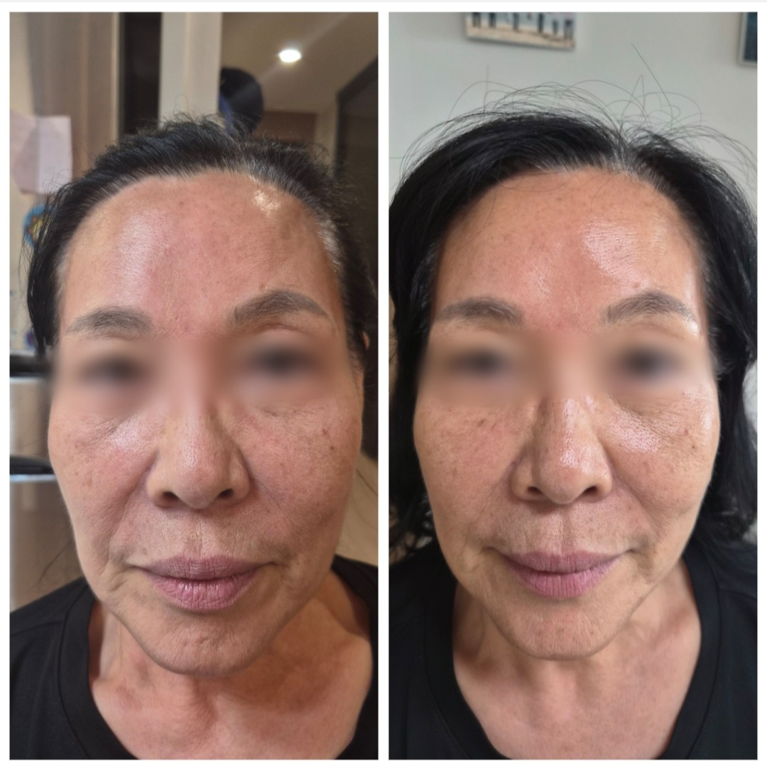리프트스킨케어 마곡피부관리 대표 이미지